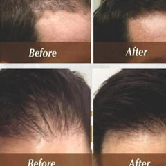 FGE Plus Hair Growth Spray 50 ml each Pack of 2