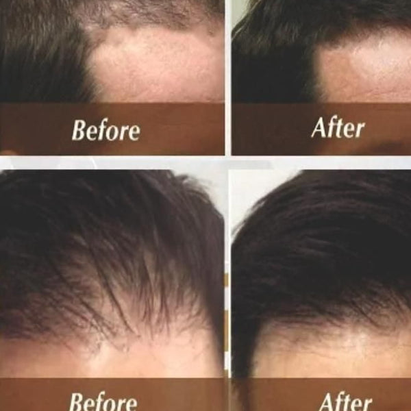 FGE Plus Hair Growth Spray 50 ml each Pack of 2